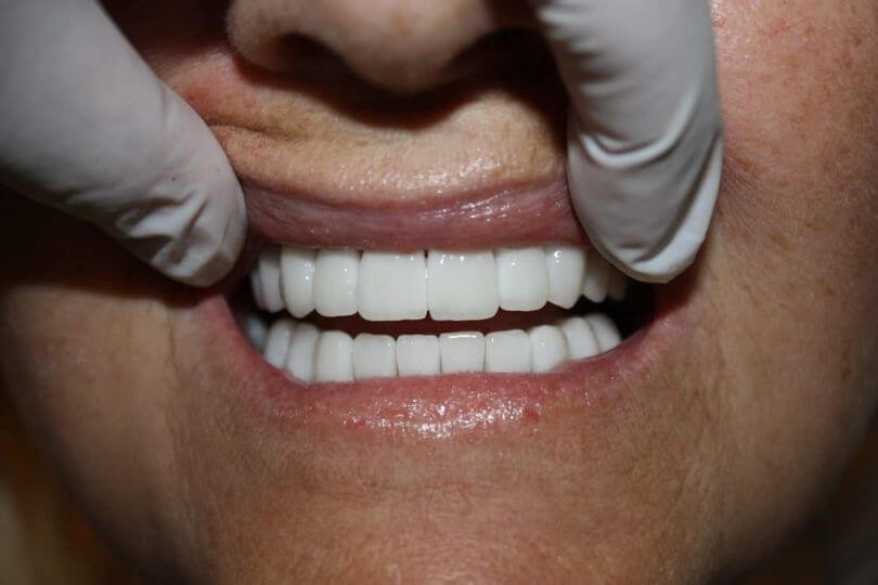 Οδοντιατρική Τεχνολογία